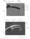 Fig. 17 - SHOE TREATMENT