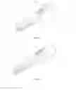 Fig. 34 - Multiple Purpose Hair Dryer
