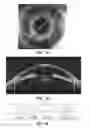 Fig. 27 - METHOD AND APPARATUS FOR DETERMINING EYE TOPOLOGY