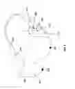 Fig. 04 - Tracking eye recovery