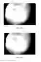 Fig. 14 - HAND-HELD PORTABLE FUNDUS CAMERA FOR SCREENING PHOTOGRAPHY