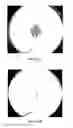 Fig. 16 - HAND-HELD PORTABLE FUNDUS CAMERA FOR SCREENING PHOTOGRAPHY