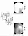 Fig. 17 - HAND-HELD PORTABLE FUNDUS CAMERA FOR SCREENING PHOTOGRAPHY