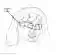 Fig. 01 - Systems for collecting thermal measurements of the face