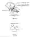 Fig. 05 - Layered and multi-sectional pulse wave sensors and use thereof
