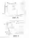 Fig. 09 - Use of detection profiles in an implantable medical device