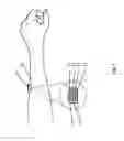 Fig. 03 - EMG Home Trainer