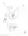 Fig. 07 - MENTAL STATE ANALYSIS USING WEB SERVERS