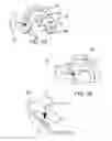 Fig. 02 - ORAL APPARATUS WITH RIGID SENSOR CAPTURE COMPONENT FOR STRONG COUPLING TO UPPER JAW