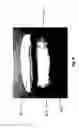 Fig. 09 - ORAL APPARATUS WITH RIGID SENSOR CAPTURE COMPONENT FOR STRONG COUPLING TO UPPER JAW