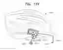Fig. 72 - Apparatus and method for measuring biologic parameters