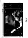 Fig. 04 - Hand-held medical imaging system with improved user interface for deploying on-screen graphical tools and associated apparatuses and methods