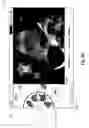Fig. 07 - Hand-held medical imaging system with improved user interface for deploying on-screen graphical tools and associated apparatuses and methods