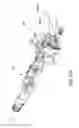 Fig. 94 - SYSTEM AND METHOD FOR EXTRACTION OF HAIR FOLLICLE