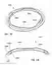 Fig. 32 - Wound retractor