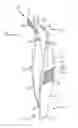 Fig. 04 - Forceps with integrated blade