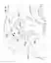 Fig. 45 - Electrically self-powered surgical instrument with manual release