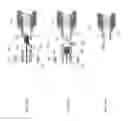 Fig. 06 - Micrograft for the treatment of intracranial aneurysms and method for use