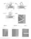 Fig. 11 - Micrograft for the treatment of intracranial aneurysms and method for use