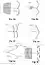 Fig. 05 - Left Atrial Appendage Occluder