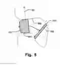 Fig. 06 - Left Atrial Appendage Occluder