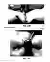 Fig. 09 - DEVICES AND METHODS FOR OCCLUDING AN ATRIAL APPENDAGE