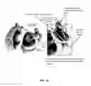 Fig. 20 - DEVICES AND METHODS FOR OCCLUDING AN ATRIAL APPENDAGE