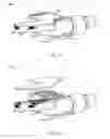 Fig. 09 - SURGICAL MICRO-SHEARS AND METHODS OF FABRICATION AND USE