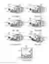 Fig. 15 - SURGICAL MICRO-SHEARS AND METHODS OF FABRICATION AND USE
