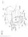 Fig. 06 - Cutter for tissue-removing catheter