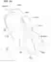 Fig. 07 - Cutter for tissue-removing catheter