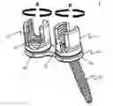Fig. 01 - Spinal anchoring system