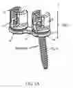 Fig. 02 - Spinal anchoring system