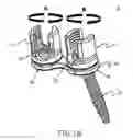 Fig. 03 - Spinal anchoring system