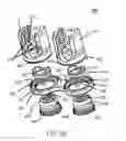 Fig. 06 - Spinal anchoring system