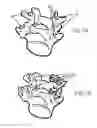 Fig. 10 - Spinal anchoring system