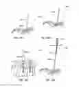 Fig. 89 - Rod inserter and methods of use