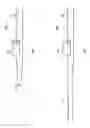 Fig. 02 - Growing rod for treating spinal deformities and method for using same