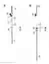 Fig. 08 - Growing rod for treating spinal deformities and method for using same