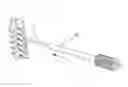 Fig. 01 - Access assembly for anterior and lateral spinal procedures