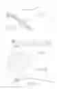 Fig. 06 - ORTHOPEDIC PLATE FOR USE IN SMALL BONE REPAIR