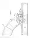 Fig. 06 - Systems and methods systems related to electrosurgical wands with screen electrodes