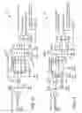 Fig. 13 - Electrosurgical method and apparatus with varying stiffness capture components