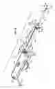 Fig. 18 - Electrosurgical method and apparatus with varying stiffness capture components