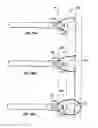Fig. 24 - Electrosurgical method and apparatus with varying stiffness capture components