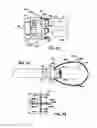 Fig. 27 - Electrosurgical method and apparatus with varying stiffness capture components
