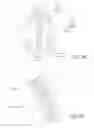 Fig. 03 - Methods and devices to treat nasal airways