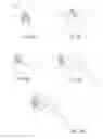 Fig. 10 - Methods and devices to treat nasal airways