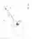 Fig. 33 - Methods and devices to treat nasal airways