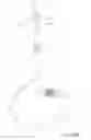 Fig. 35 - Methods and devices to treat nasal airways
